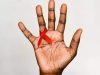 52 Orang di Palangkaraya Terjangkit HIV/AIDS