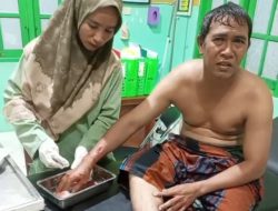 Sedang Wudhu, Tiba-tiba Tangan Disambar Buaya 4 Meter! Warga Kotim Nyaris Tewas